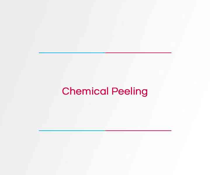 Chemical Peeling
