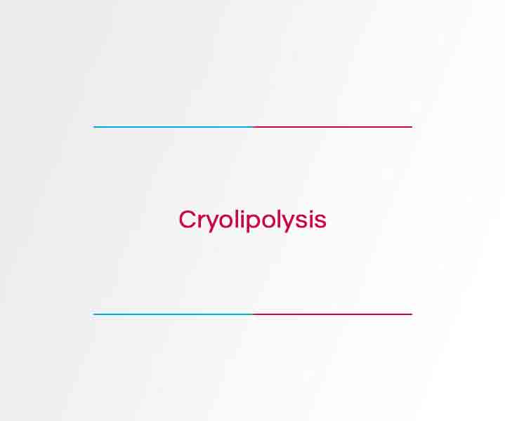 Cryolipolysis
