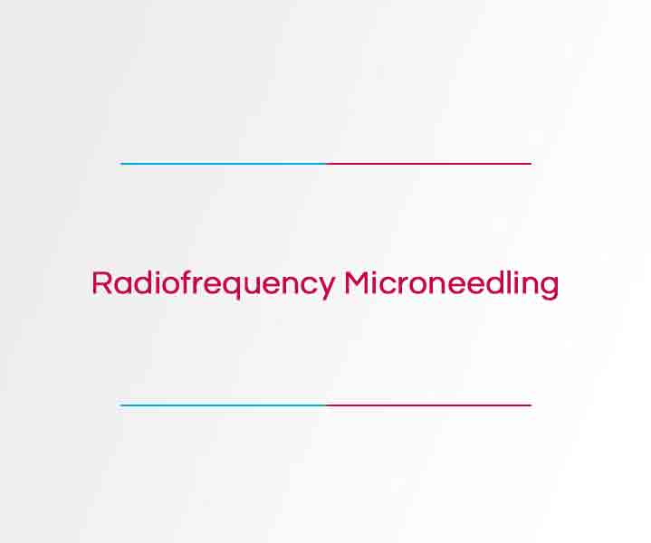 Radiofrequency microneedling
